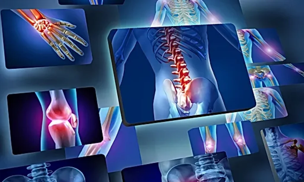 Unwinding the Complexities of Rheumatoid Joint inflammation: A Thorough Investigation