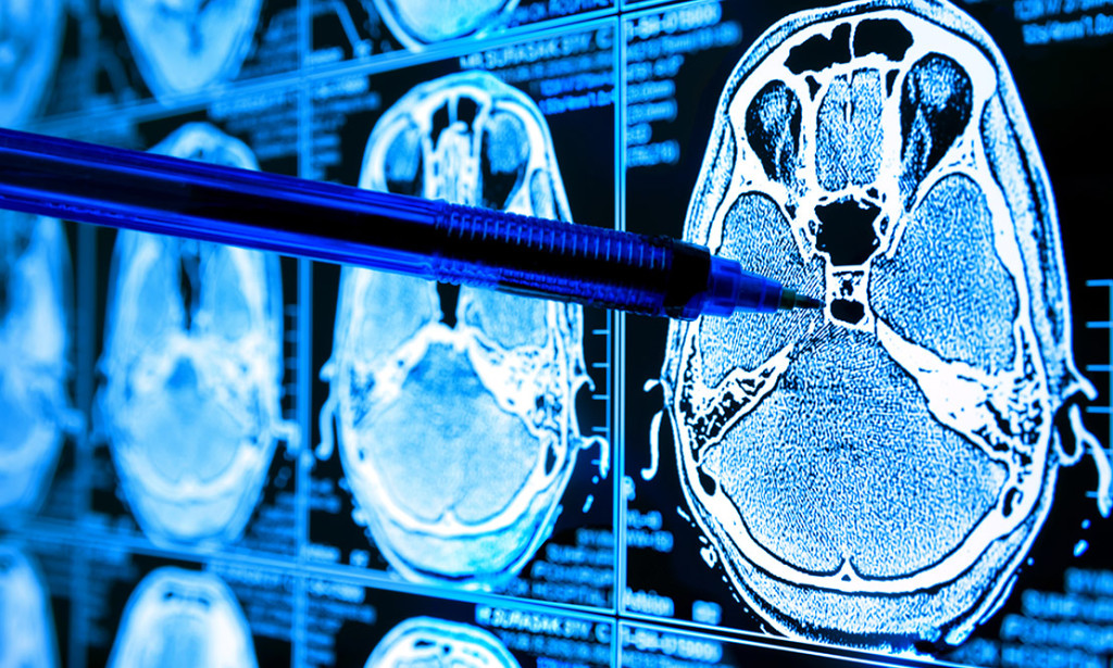 The Job of Man-made reasoning in Medical services: A Transformation in Diagnostics, Treatment, and Patient Consideration