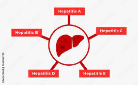 Types of Hepatitis