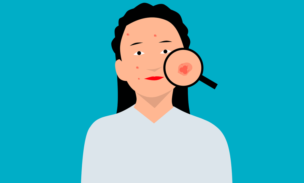 Accomplishing Clear Skin: The Total Manual for Effective Brightening Healthy skin for Acne