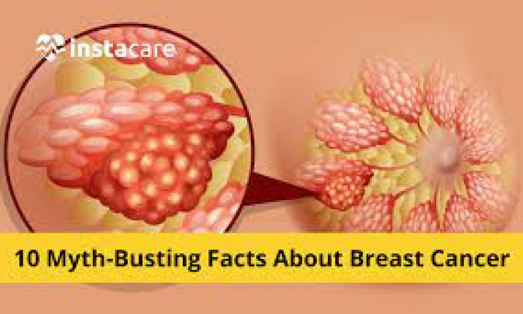 Fantasies vs Realities about Breast Malignant Growth. (Breast Cancer)