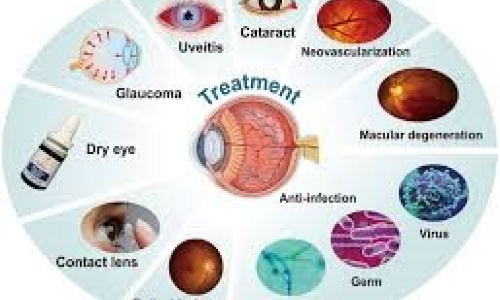 Cataracts. The eye disease. Clearing Cataracts: Vision Restoration