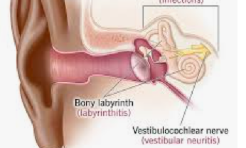 *dizziness or dizziness*    Tipsiness or dizziness isn't an illness in itself, however it can likewise be a side effect of a sickness.