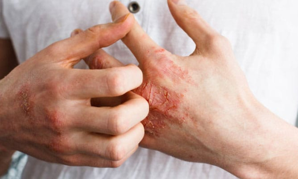 *The most effective method to be protected from heat rash diseases?*
