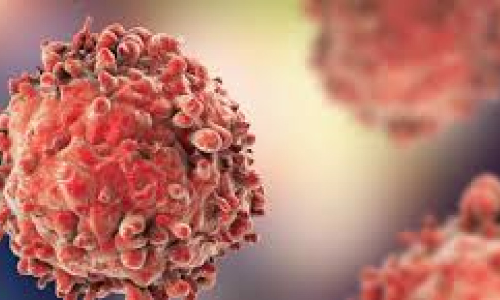 some common symptoms that people may notice before being diagnosed with cancer: